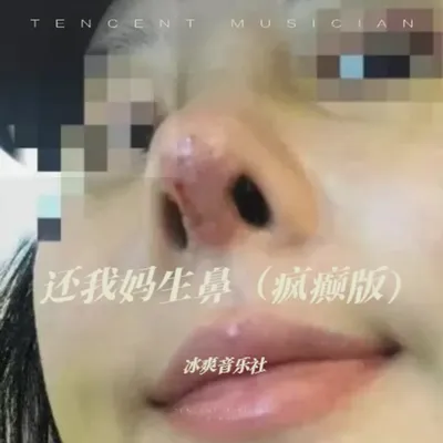 還我媽生鼻（瘋癲版）