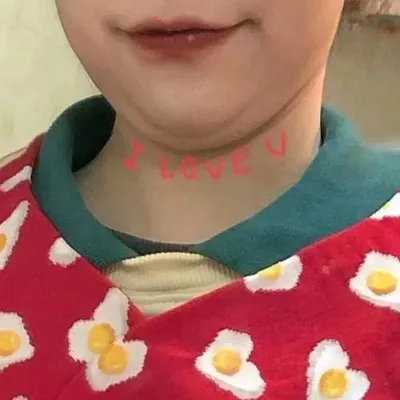 87